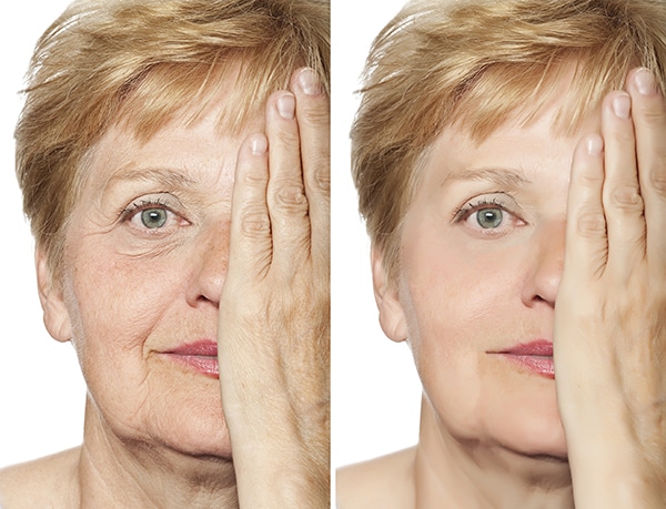 Cosmetic Botox Treatment Cosmetic Botox for women