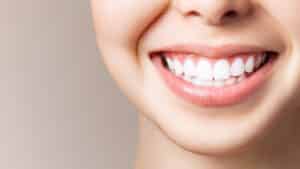 Girl smiling with very white teeth